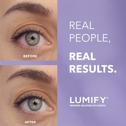 Lumify Redness Relief Eye Drops – Whiter & Brighter Looking Eyes 0.08 oz